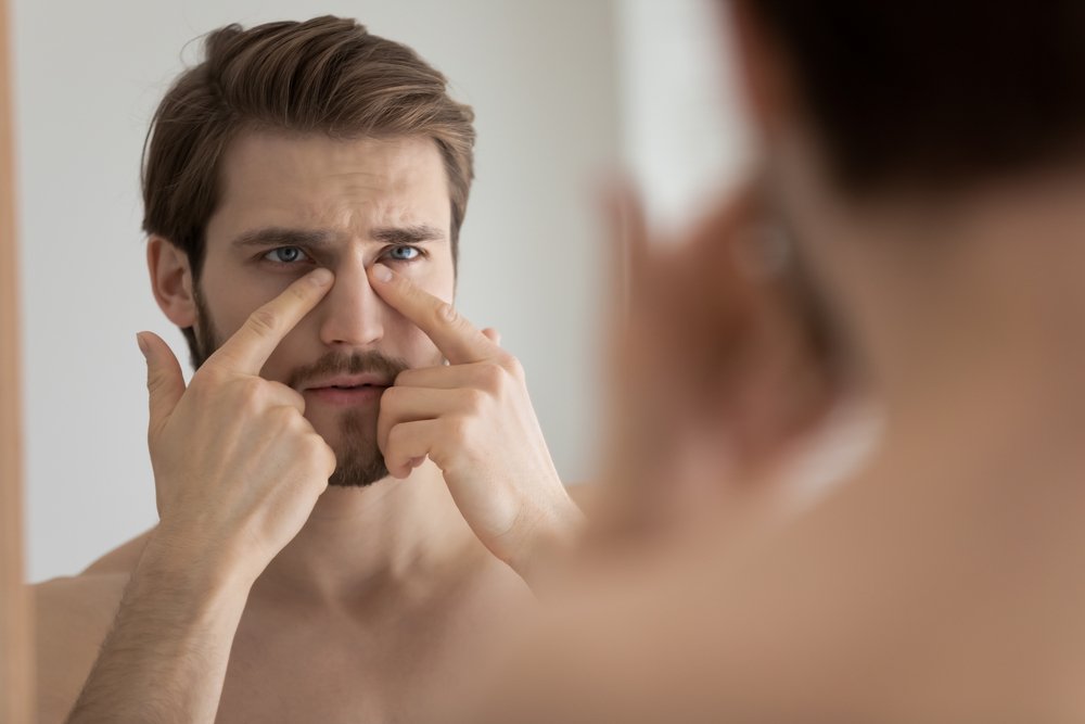eye area care